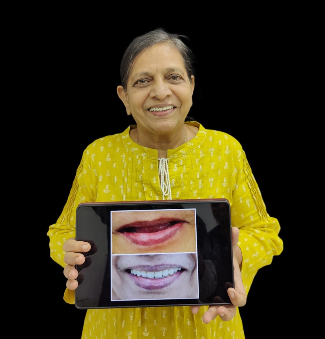 specialist dental implants