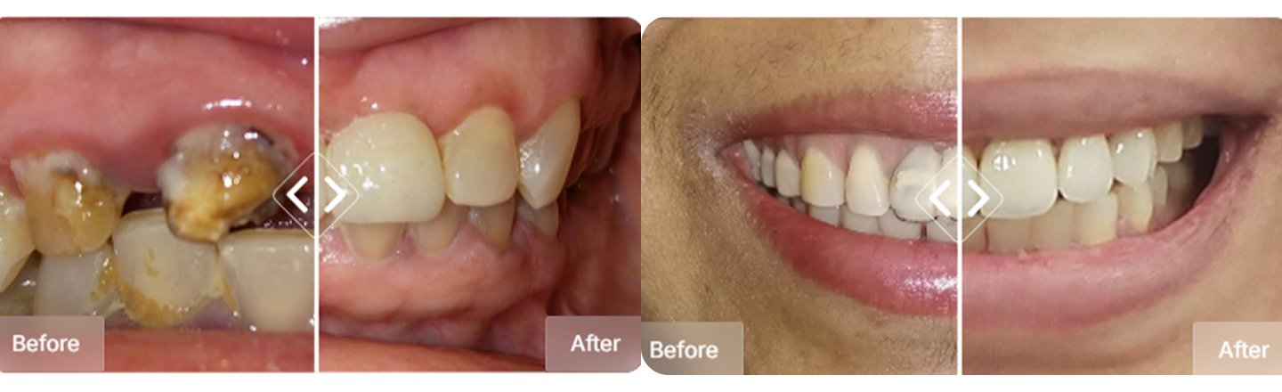 Smile transform - patient images