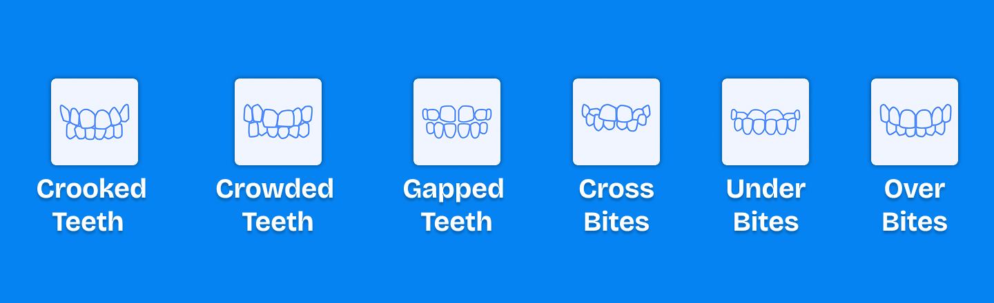 What Dental Problems Can Clear Teeth Aligners Fix