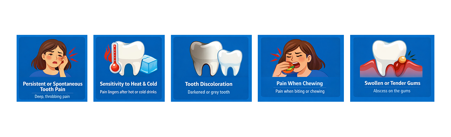 Signs you need root canal treatment